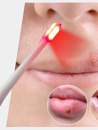soreaid cold sore treatment device